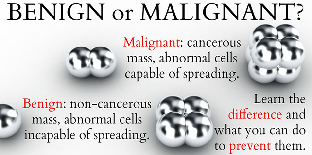 Benign or Malignant?